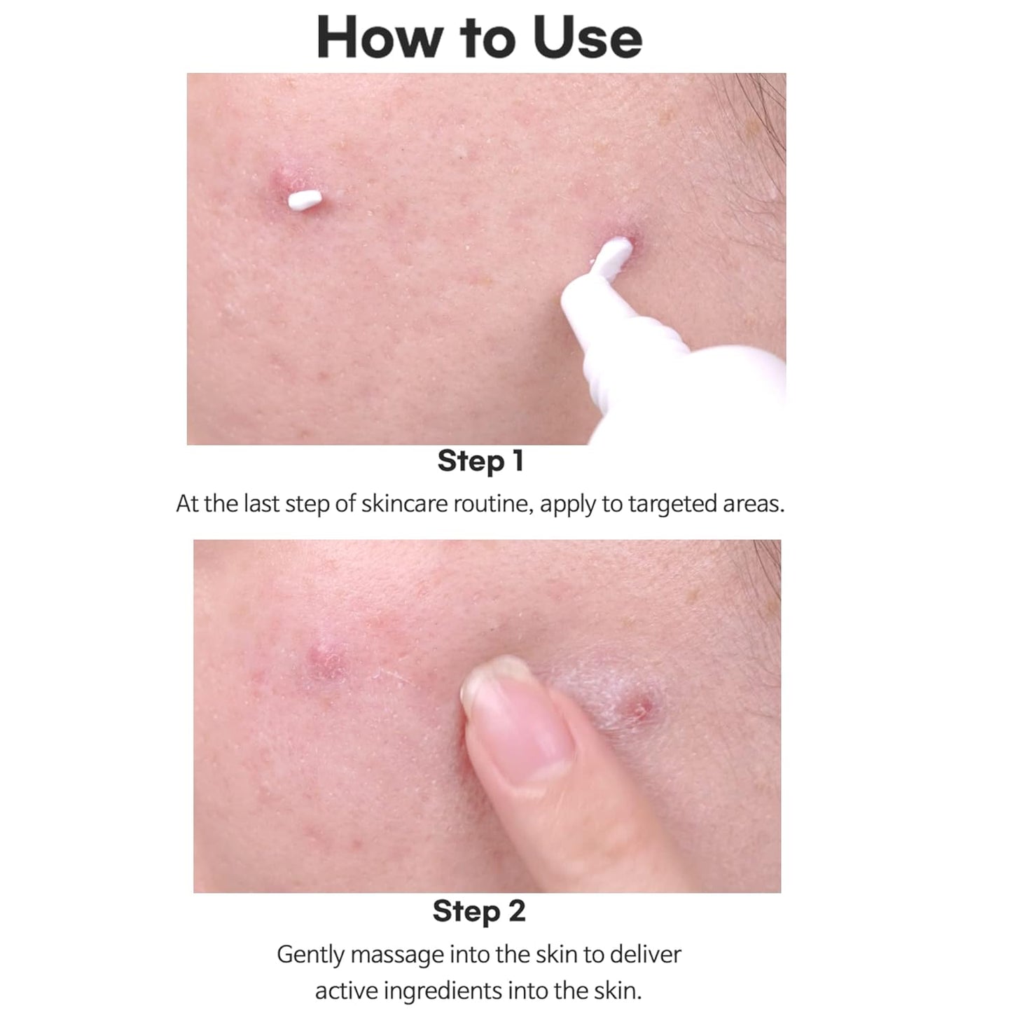 AC FIGHTING SPOT RX CREAM - TIAM