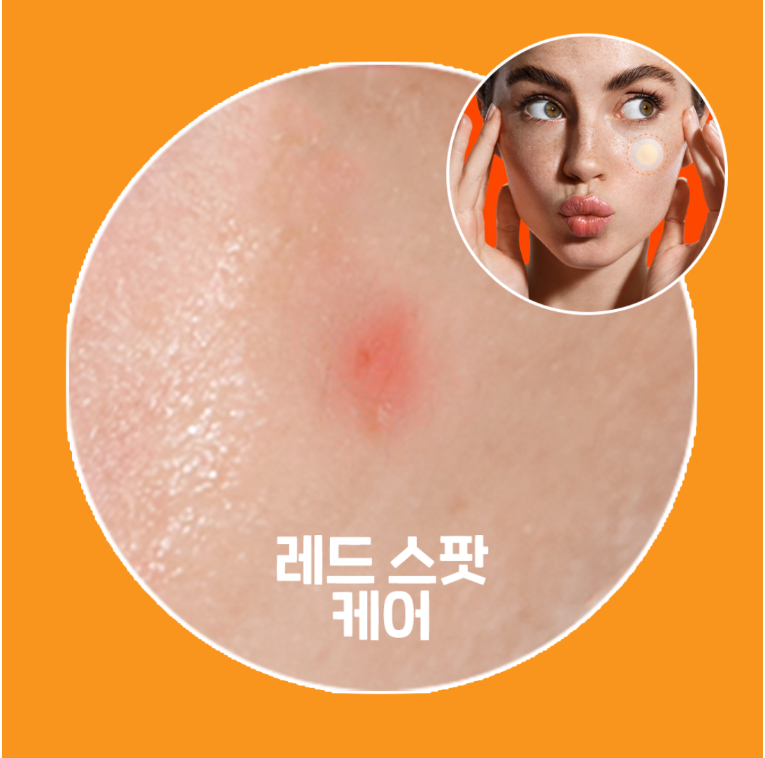 SPOT ERASER ORANGE 12 PARCHES - NOLAHOUR