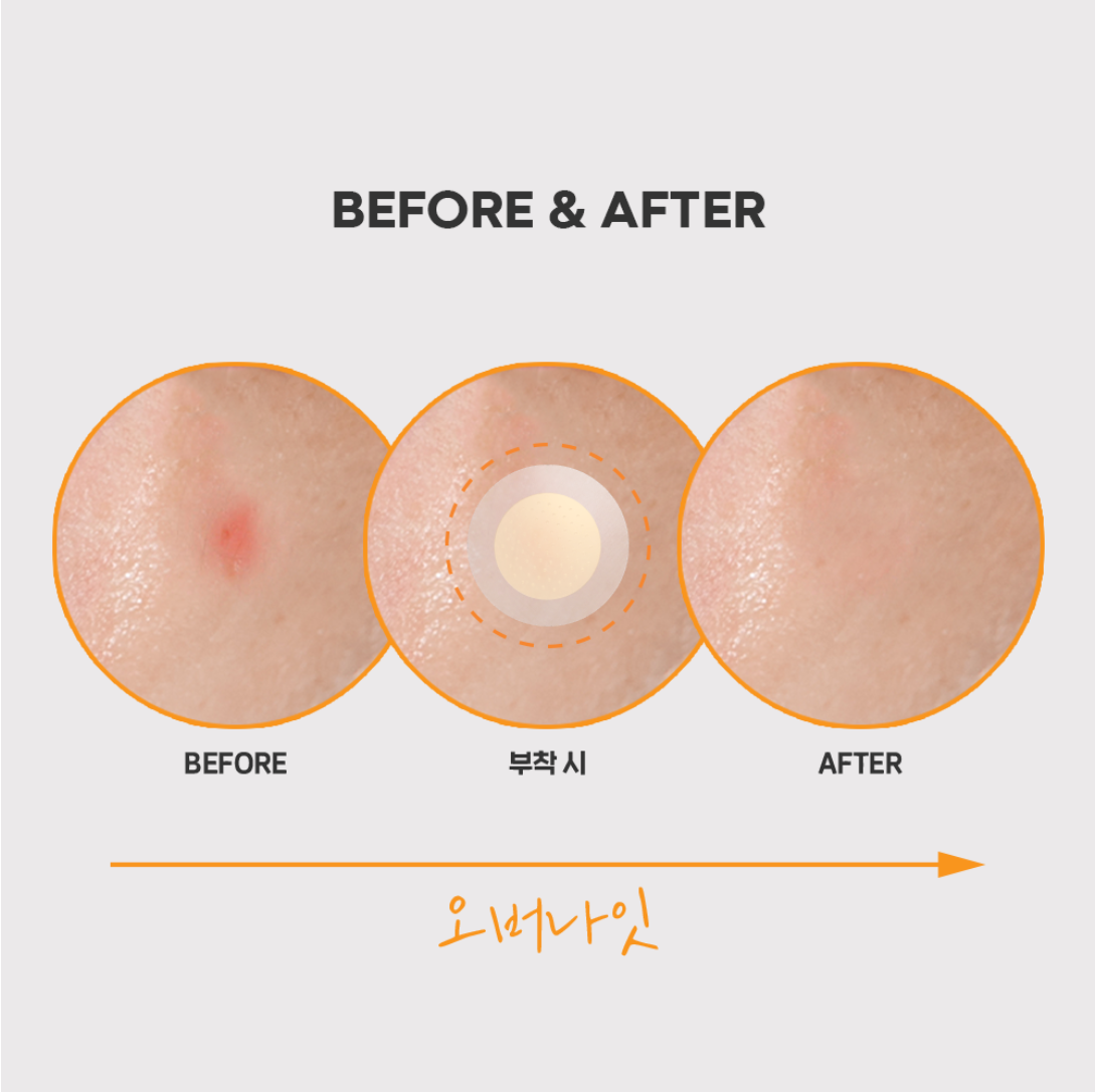 SPOT ERASER ORANGE 12 PARCHES - NOLAHOUR