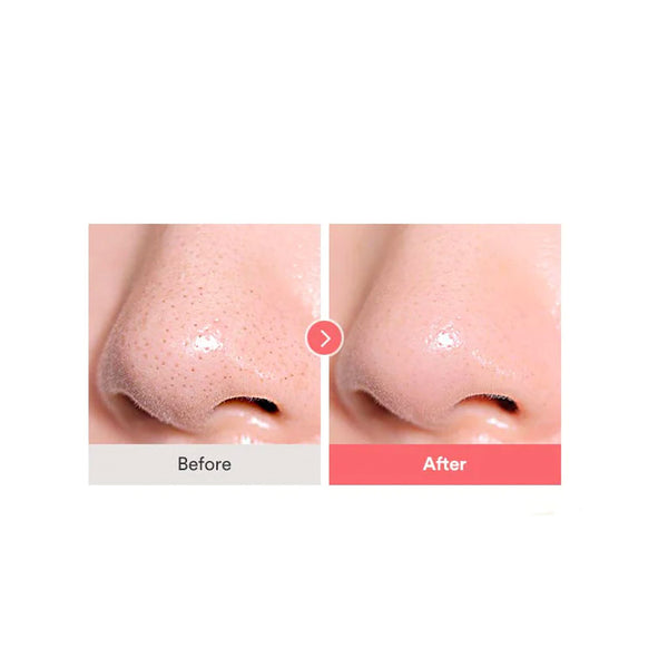 CALAMINE PORE CONTROL CLEANSING OIL - TOCOBO