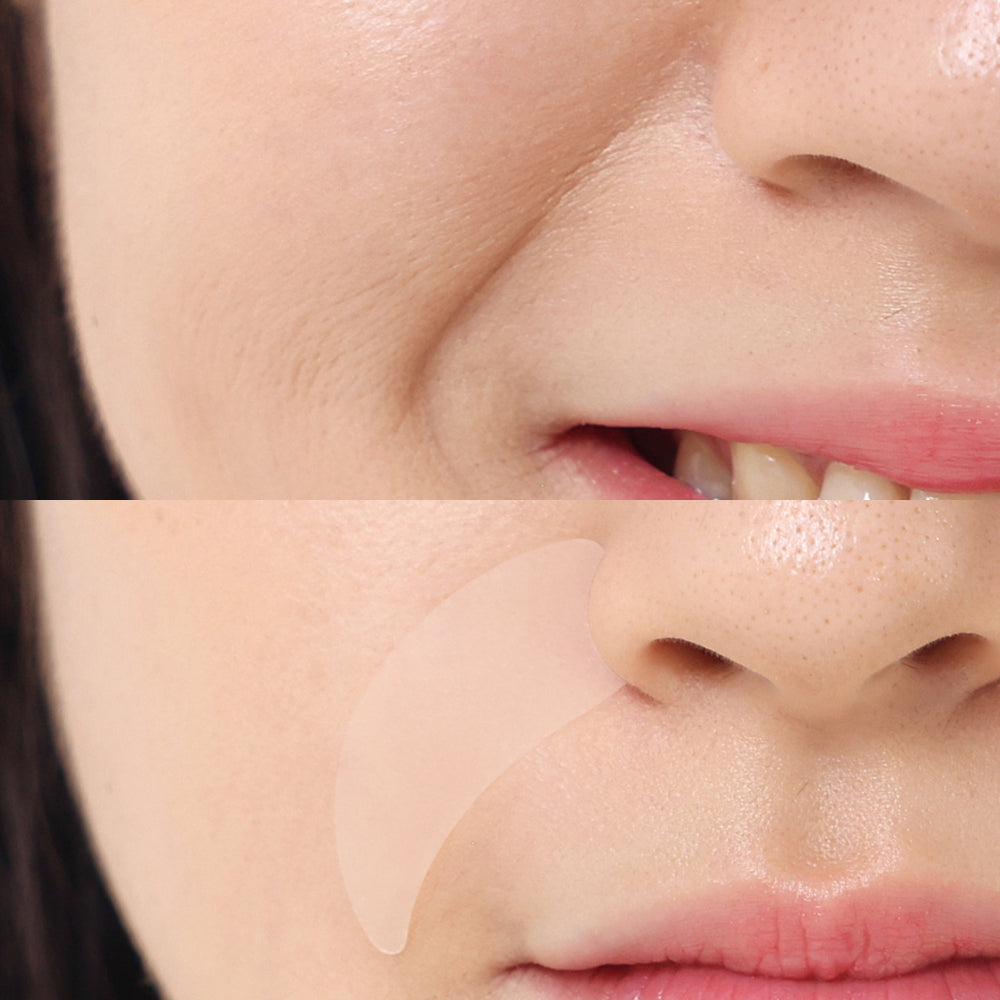 WRINKLE MASTER PATCH SMILE LINE - MADFORCOS